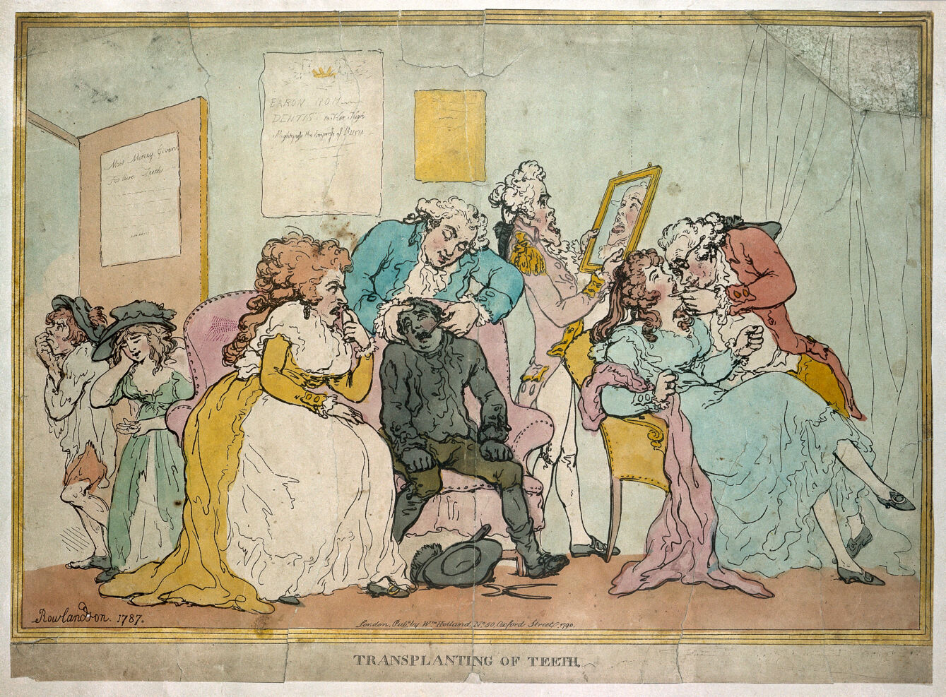Thomas Rowlandson 1787-es, „Transplanting of teeth” című korabeli illusztrációja