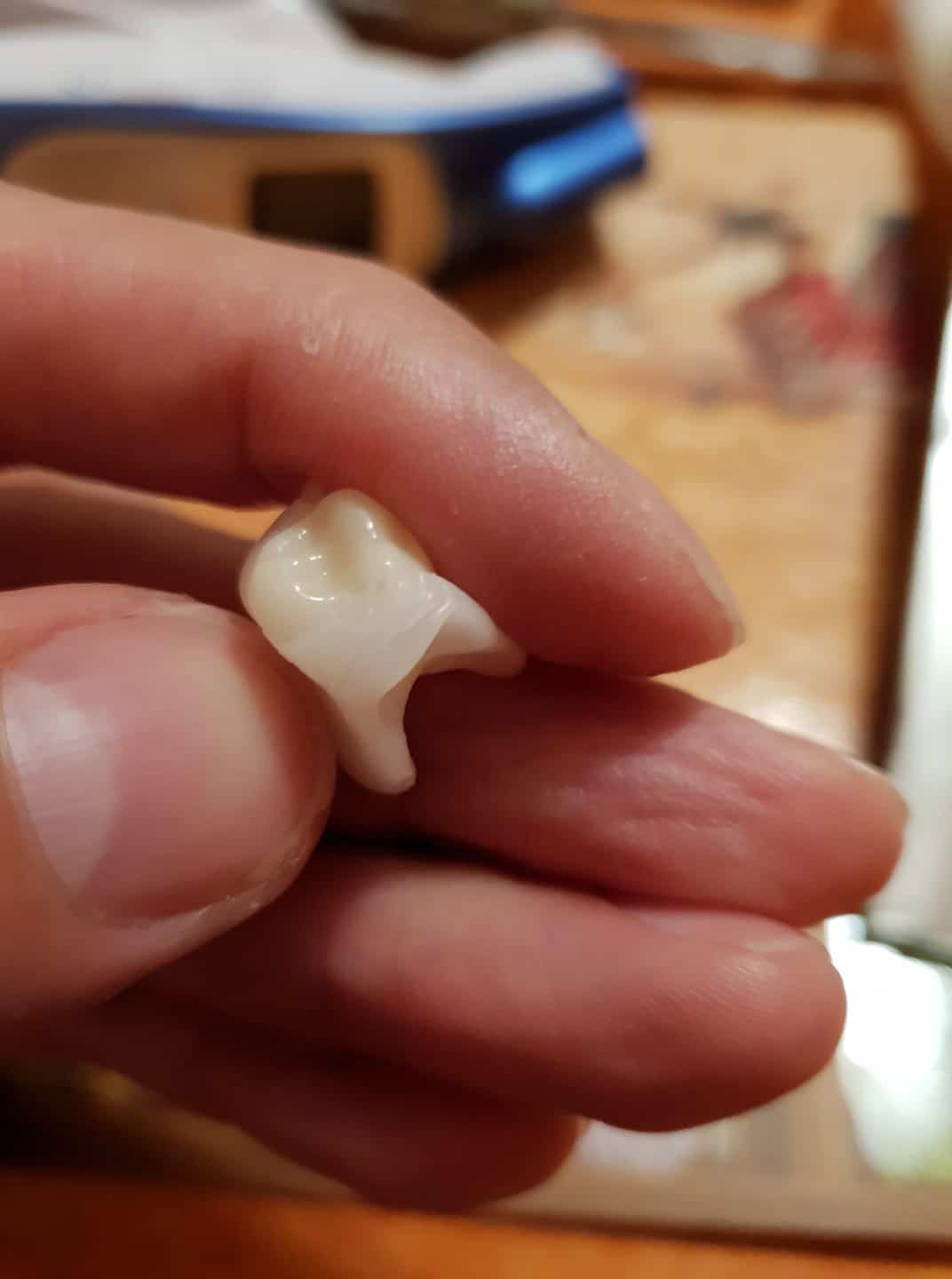 A Denticor végleges fogpótlás hónapokig tartó fejlesztés után