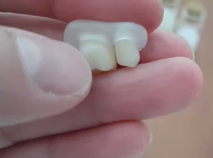 A pótlás kézben, a DentiFlexszel